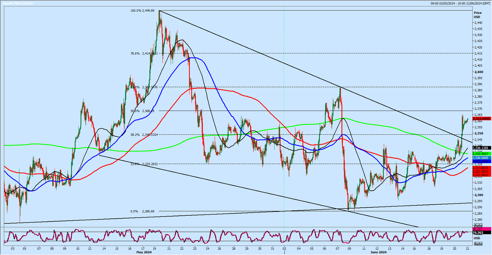 XAU/USD-Hourly Chart