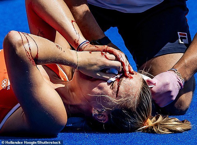 The 27-year-old suffered a sickening injury during the women's hockey semi-finals