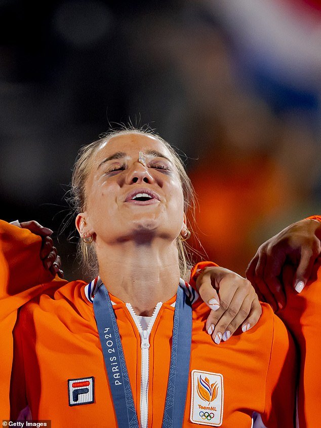 Netherlands hockey player Joosje Burg appeared with two black eyes during the medal